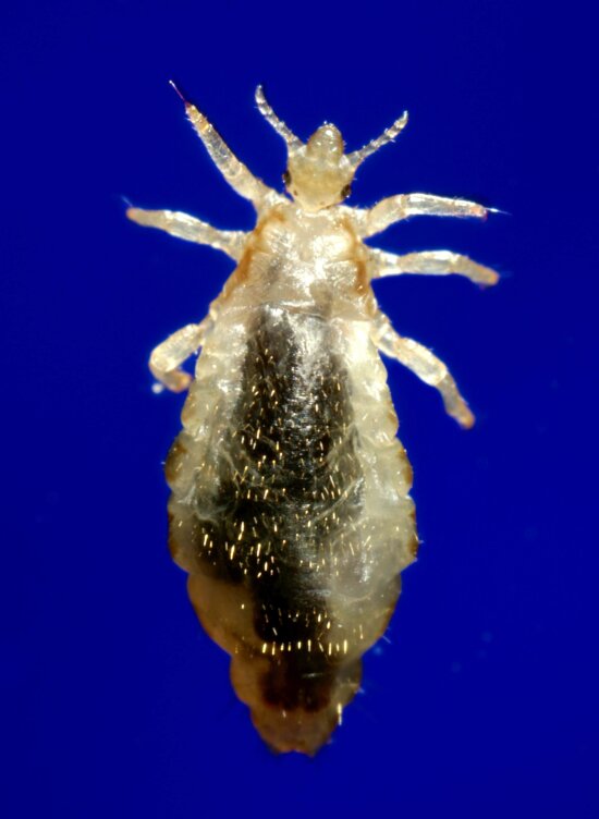 Free Picture Lateral Female Body Louse Pediculus Humanus Corporis