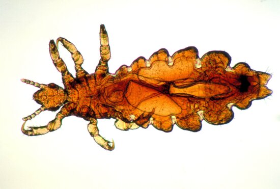 image, dorsal, female, head, louse, pediculus humanus, capitis