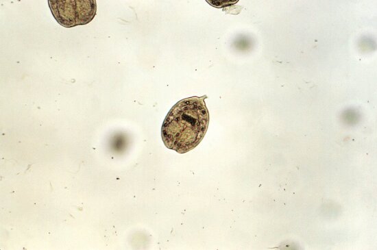 low, magnification, 100x, photomicrograph, three, echinococcus protoscolices