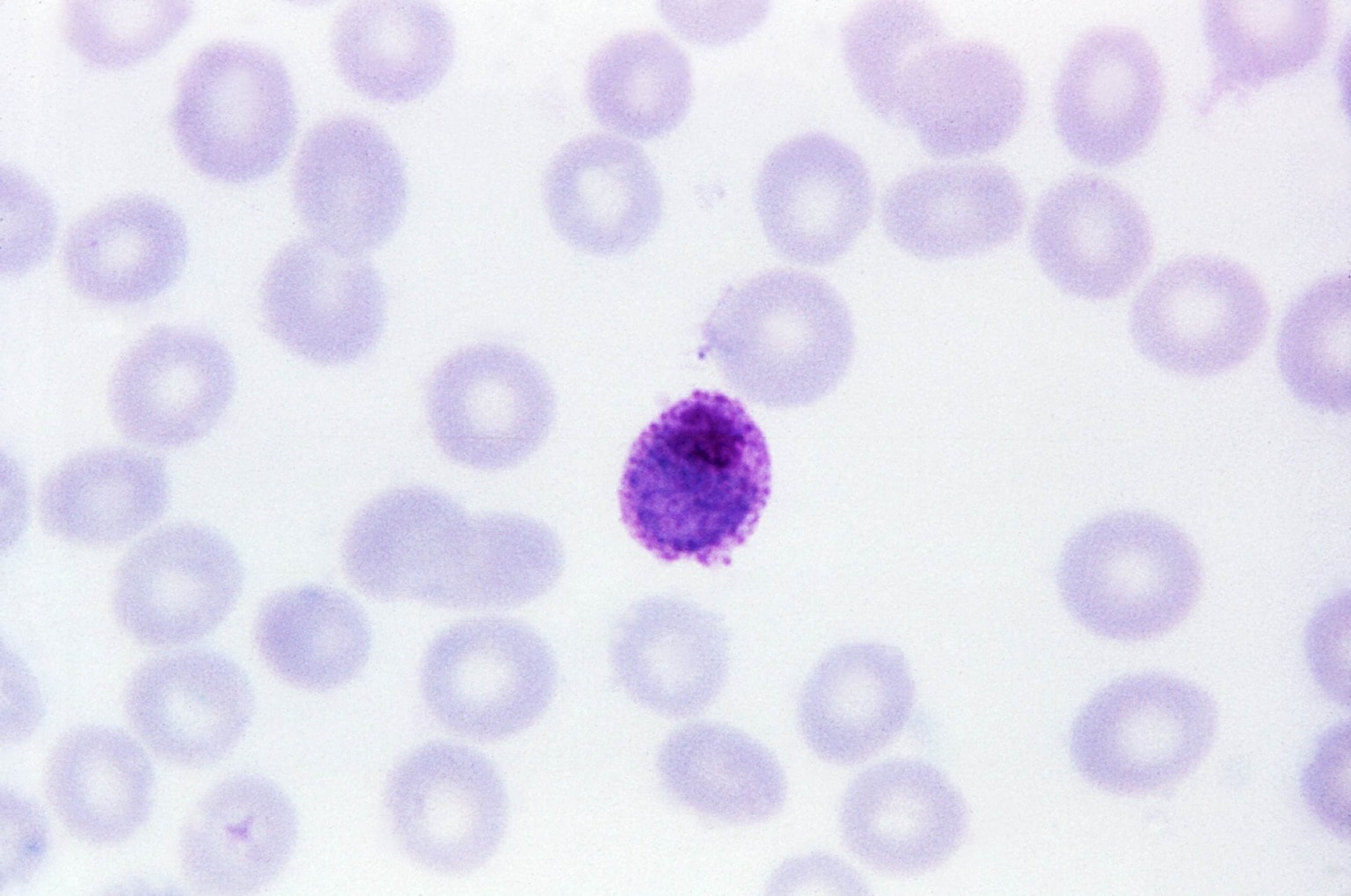 Плазмодий мазок. Plasmodium falciparum рисунок. Плазмодий овале.