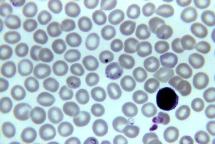 babesia, ring, formations, host, erythrocytes