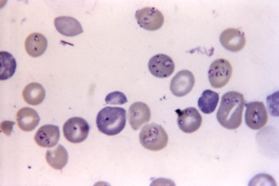Babesios, förvirrad, malaria, hemo, protozo, parasiter, släkte, babesia