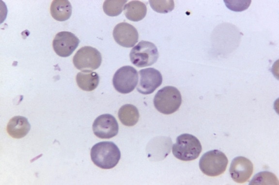 血液、細胞、バベシア、microti、マラリヤ、マグ、1125 x