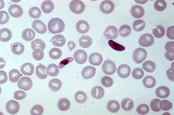 blood smear, contains, macro, microgametocyte, plasmodium falciparum, parasite