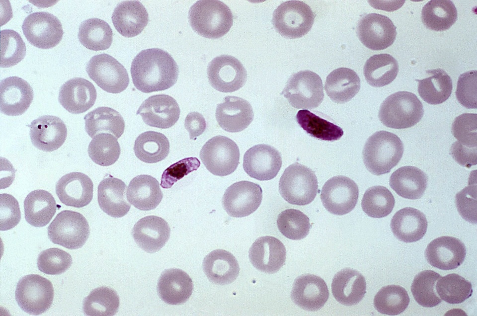 Free picture: blood smear, contains, immature, mature, trophozoites ...