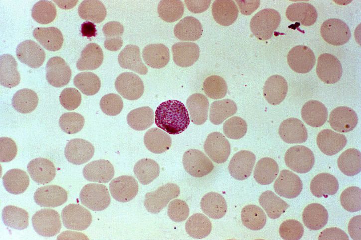 blood smear, contains, macrogametocyte, parasite, plasmodium vivax