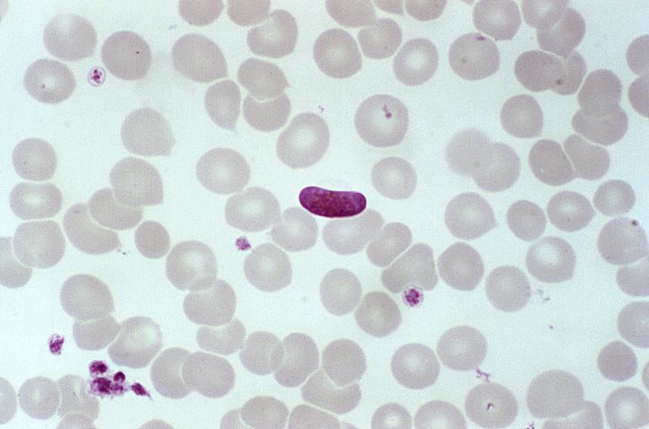 verta preparaatti, sisältää microgametocyte, loinen, plasmodium falciparum