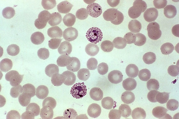 Blood uitstrijkje, bevat, onvolwassen, volwassen, trofozoïeten, plasmodium vivax, parasiet