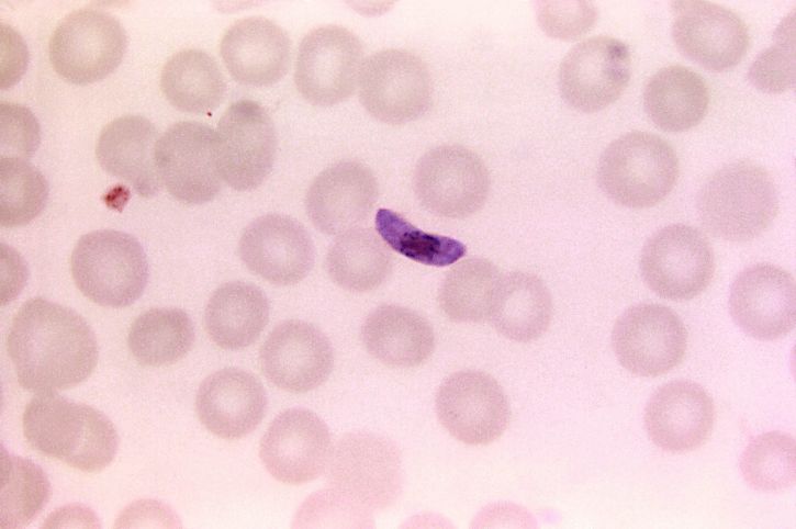 darah smear, film, mikrograf, plasmodium falciparum macrogametocyte, parasit