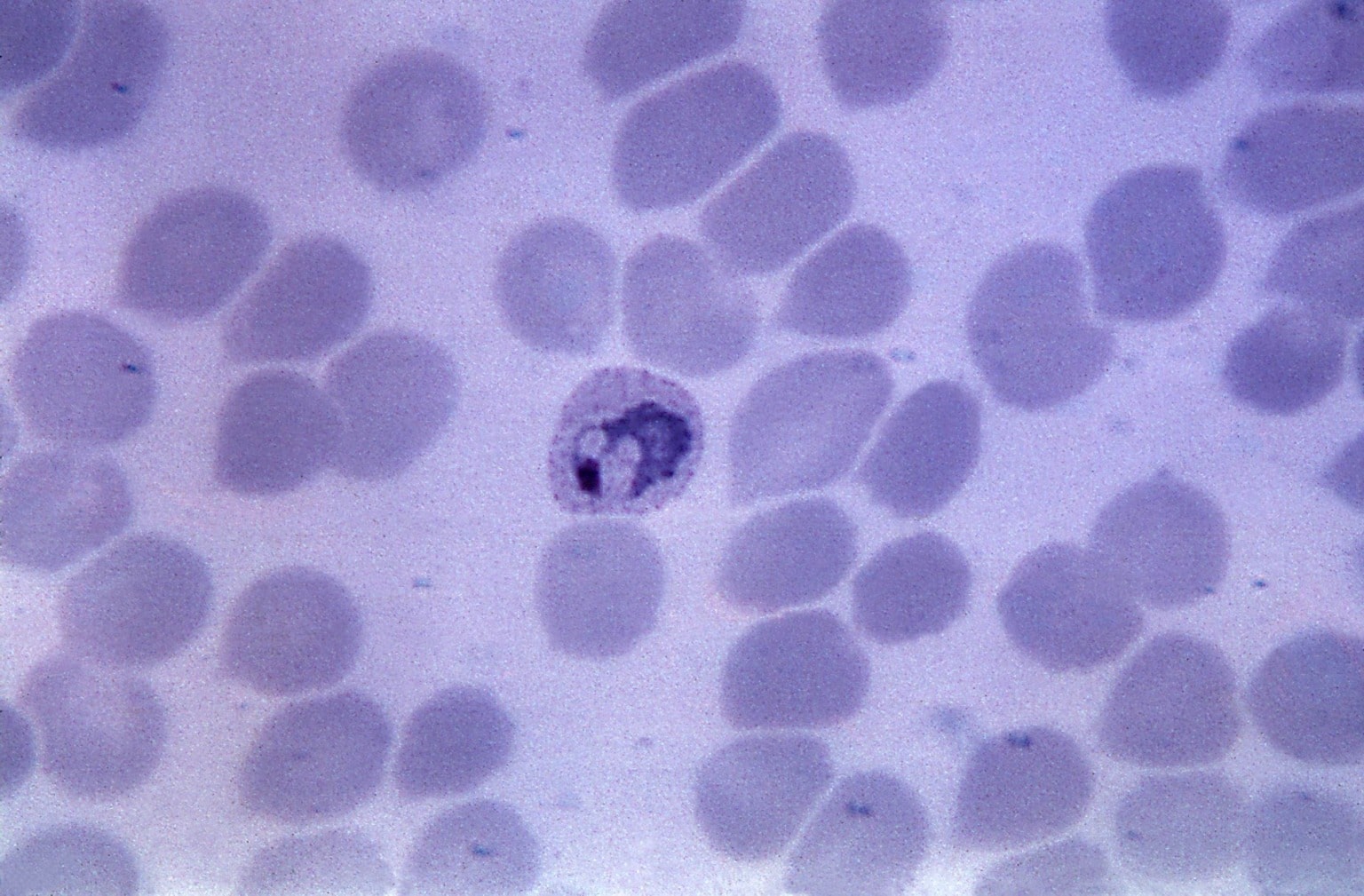 Free Picture: Blood Smear, Micrograph, Plasmodium Falciparum, Parasite ...