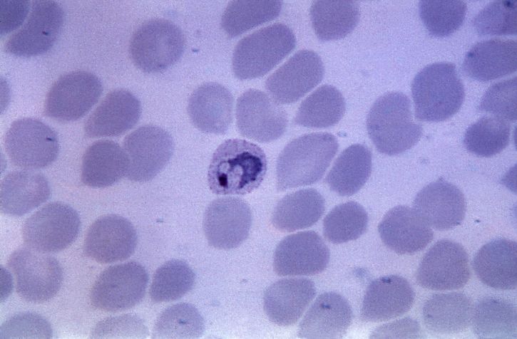 darah smear, mikrograf, tumbuh, vivax, trophozoite, diperbesar, 1125 x