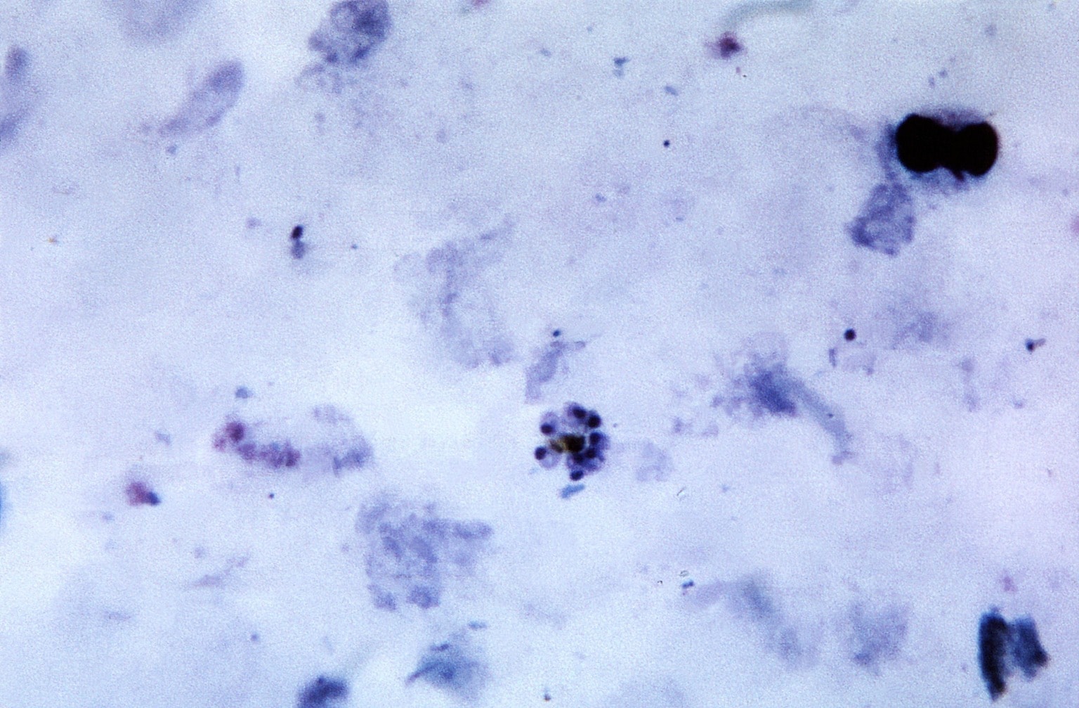 Kostenlose Bild Blutausstrich Mikroskopische Aufnahme Jung Wachsen Plasmodium Malariae