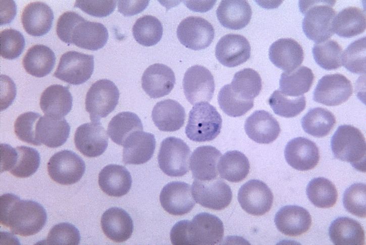 darah smear, mikrograf, vivax, cincin, Kromatin, titik-titik, diperbesar, 1125 x