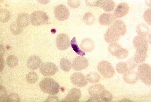 blood smear, micrograph, plasmodium falciparum macrogametocyte, parasite