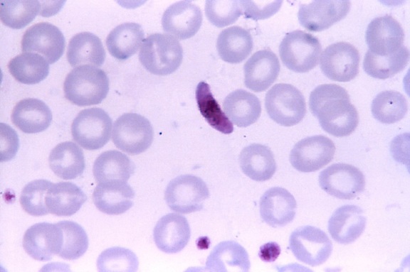κηλίδα αίματος, μικρογραφία, plasmodium falciparum, παράσιτο, microgametocyte