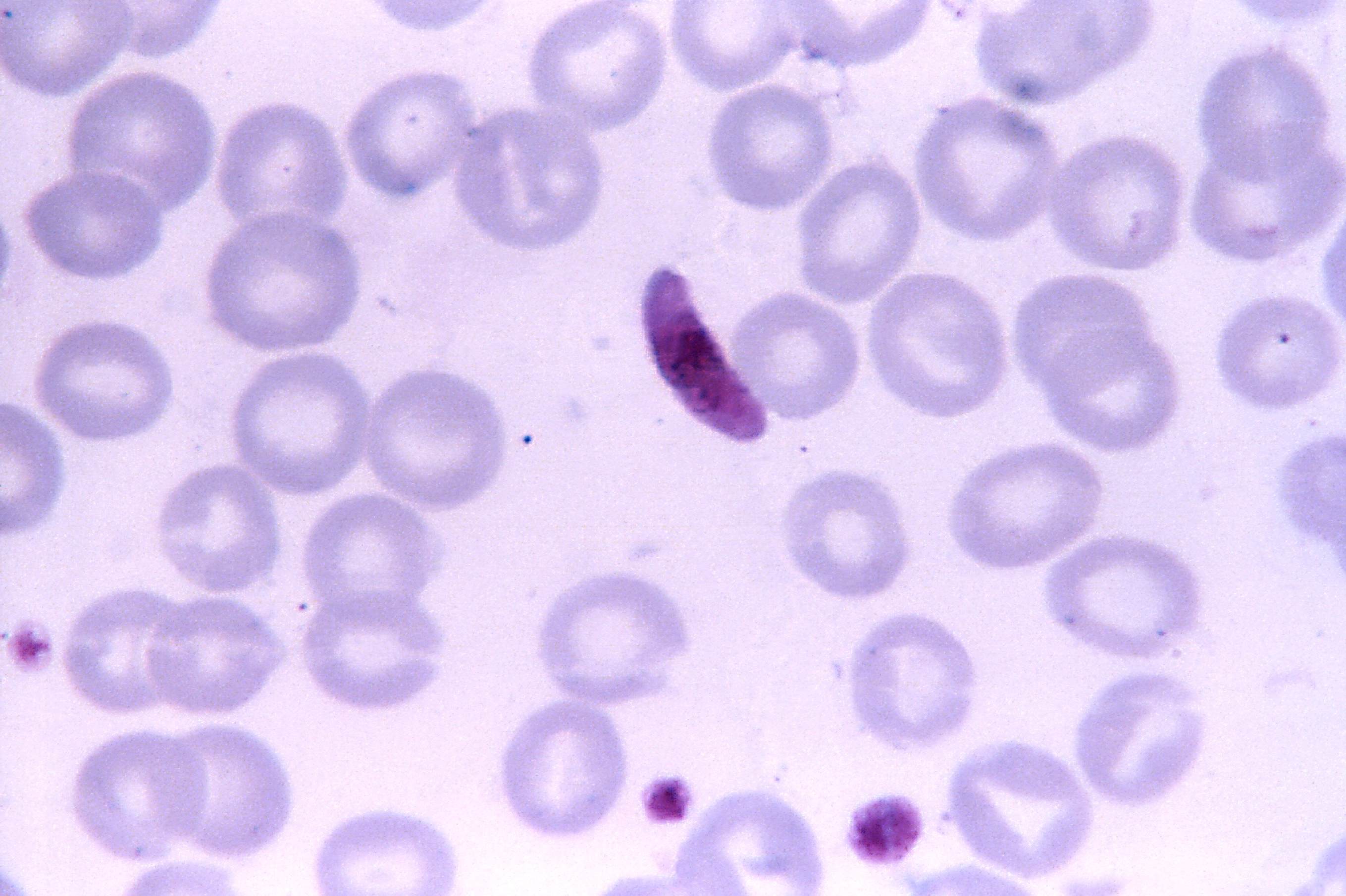 malária plazmodium mikrogametocita