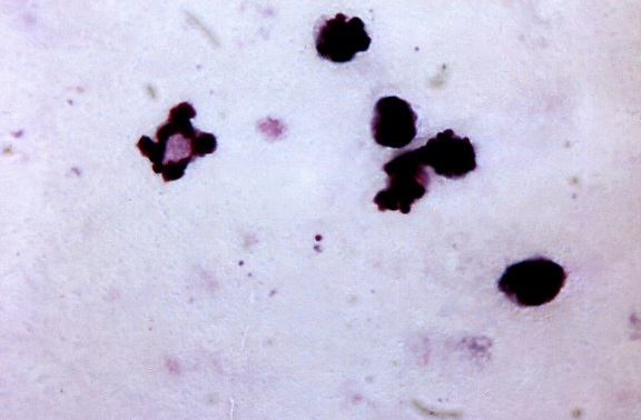 blood smear, micrograph, young, growing, plasmodium malariae, trophozoite, past, ring, stage