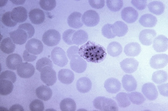 mancha de sangue, Micrografia, imatura, vivax, schizont, cromatina, massas, ampliadas, 1125 x