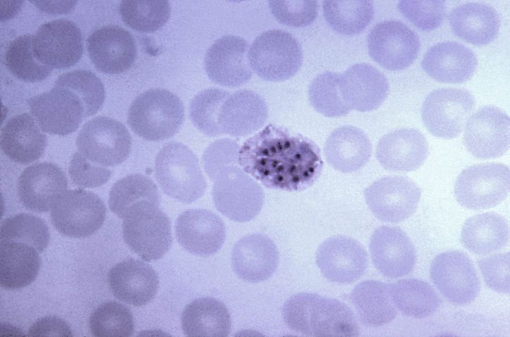 blood smear, micrograph, immature, vivax, schizont, chromatin, masses, magnified, 1125x