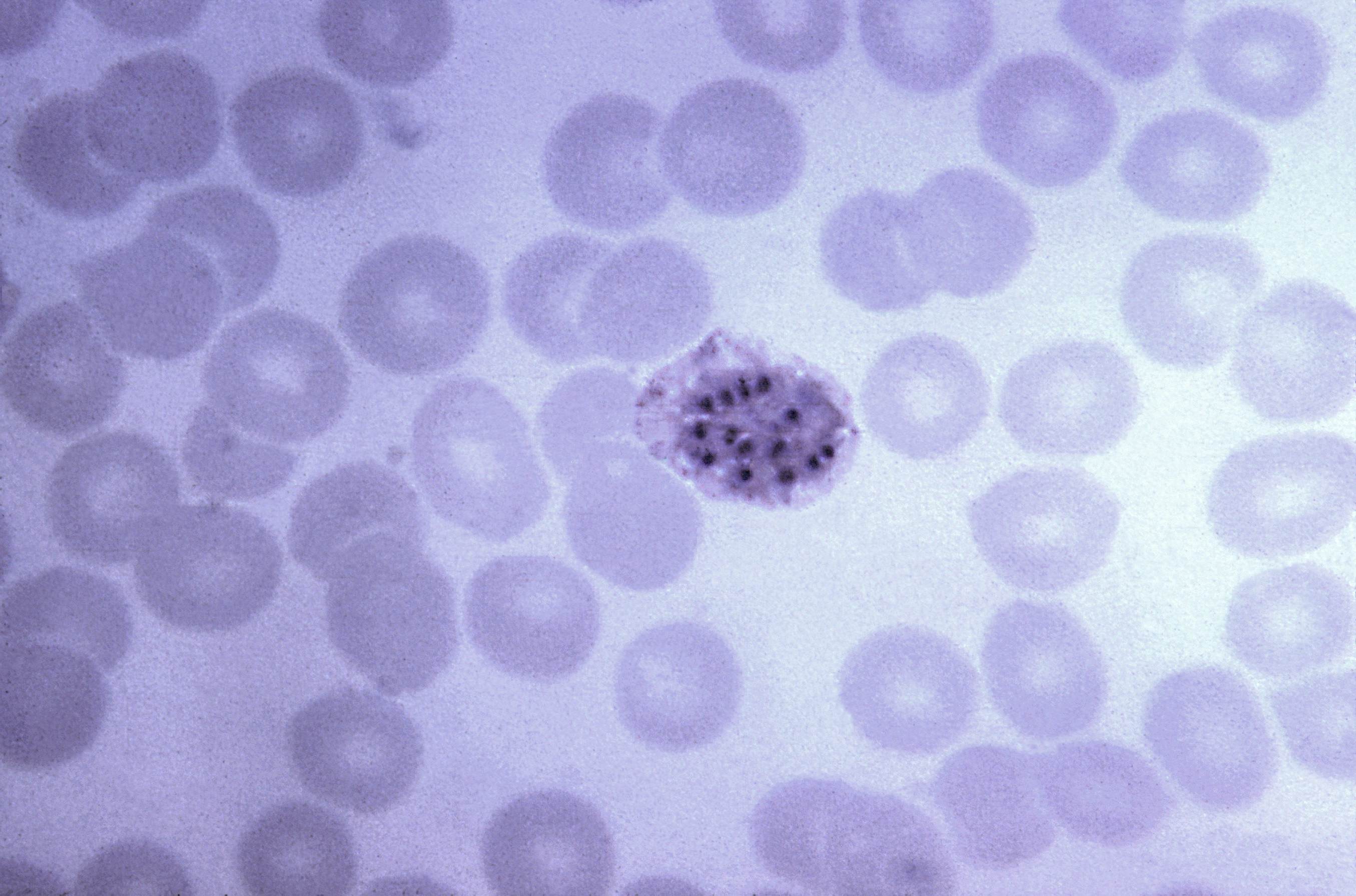 Кровь на малярию. Малярийный плазмодий. Плазмодий Vivax. Plasmodium malariae микроскопия. Малярийный плазмодий микроскоп.