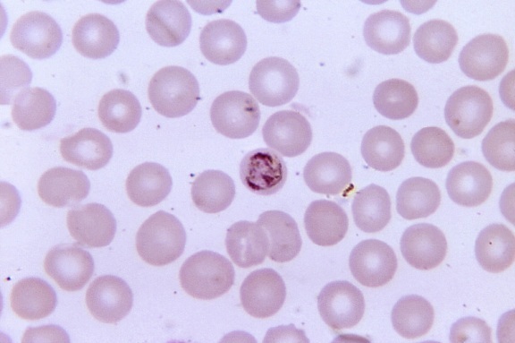 blood smear, micrograph, immature, plasmodium malariae, schizont, contains, three, chromatin, masses