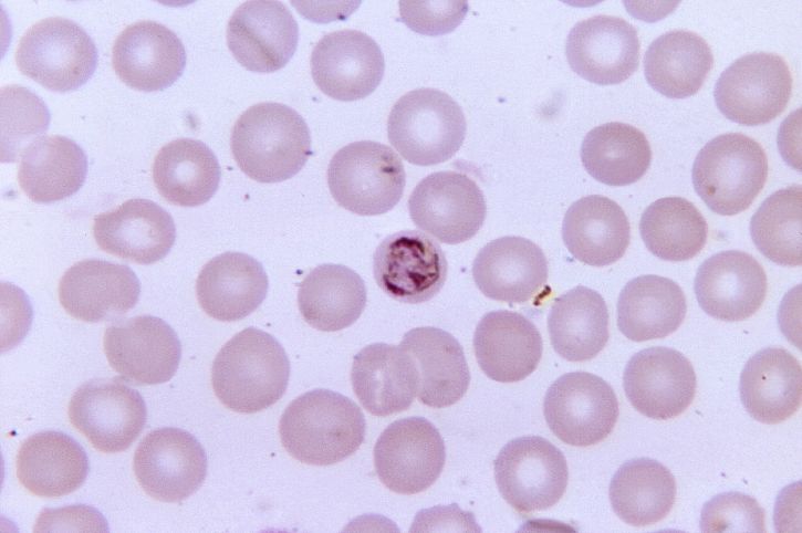 razmaz krvi, mikroskopa, nezreli, plasmodium malariae, schizont, sadrži, tri, chromatin, mase