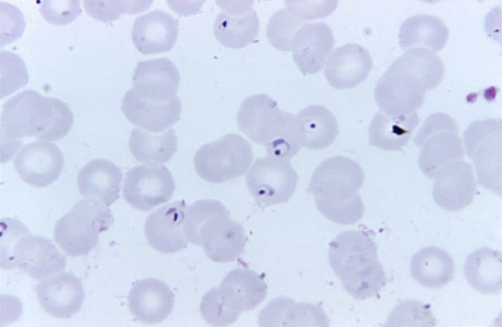 striscio di sangue, Plasmodium falciparum, l'anello, la forma, i parassiti, macchia, MAG, 1125x