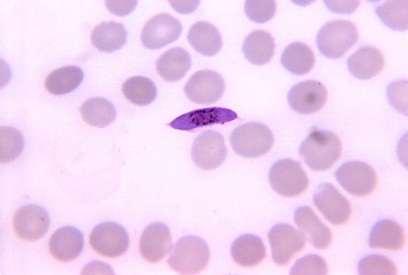 frotis de sangre, Plasmodium falciparum, macrogametocito, mancha, mag, 1125x