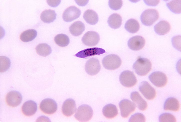 falciparum macrogametocyte, plama, mag, rozmaz krwi, 1125 x
