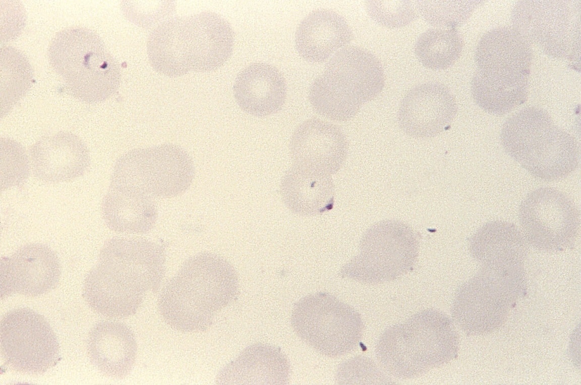 Free Picture Blood Smear Two Ring Form Plasmodium Falciparum Parasites Stain Mag X