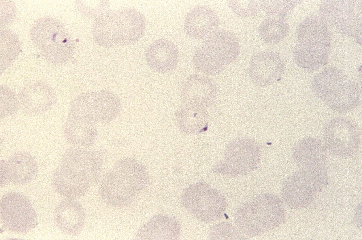 Kostenlose Bild Blutausstrich Mikroskopische Aufnahme Jung Wachsen Plasmodium Malariae