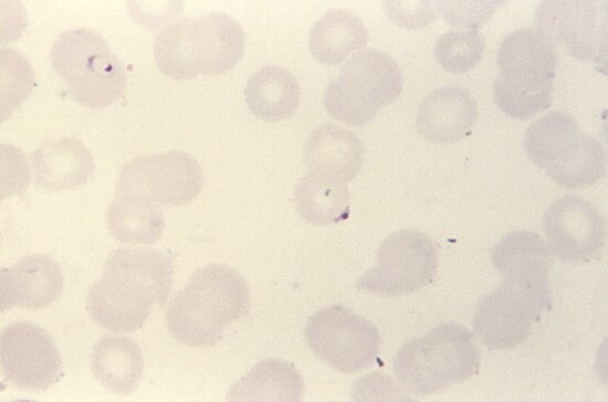 Imagen Gratis Frotis De Sangre Micrograf A Plasmodium Falciparum Par Sito Microgametocito