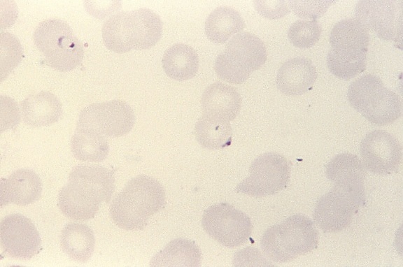 frotis de sangre, dos, anillo, forma, Plasmodium falciparum, parásitos, mancha, mag, 1125x