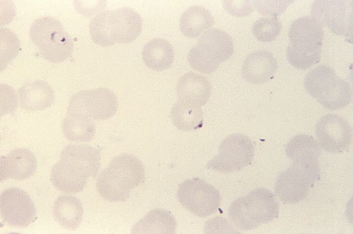 bloed-uitstrijkje, twee, ring vorm, plasmodium falciparum, parasieten, vlek, mag, 1125 x