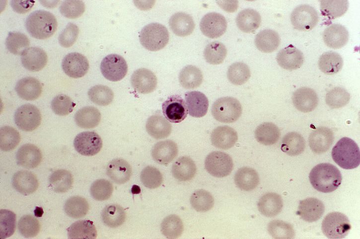 sânge frotiu, eritrocite, în curs de dezvoltare, falciparum, paraziţi, amplificată, 1000 x