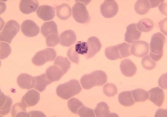 blood smear, old, immature, schizont, plasmodium malariae