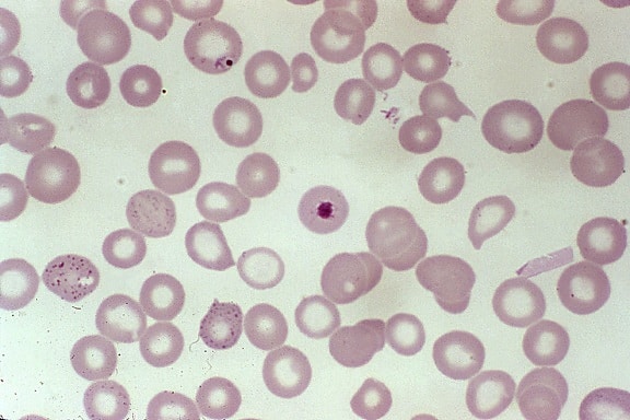 bôi nhọ máu, cho thấy, plasmodium falciparum, ký sinh trùng, nhẫn, giai đoạn, phát triển