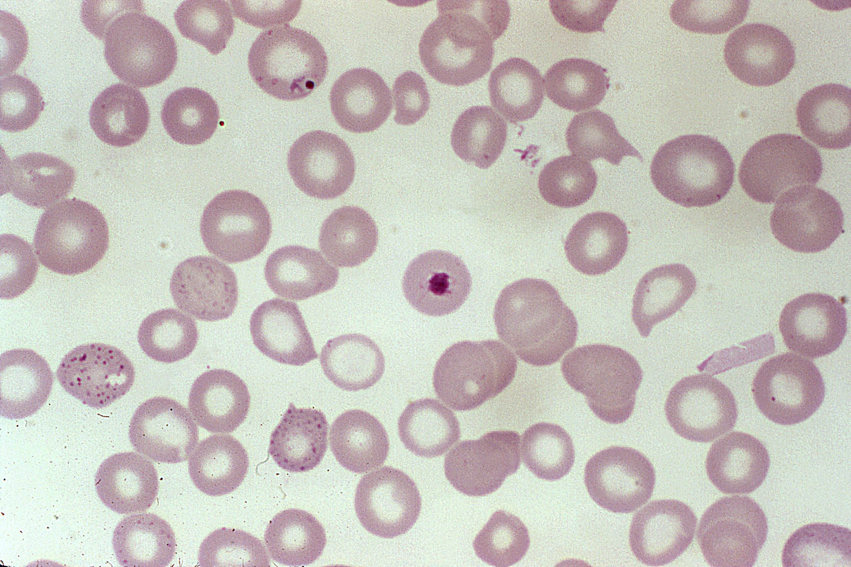 Free picture: blood smear, shows, plasmodium falciparum, parasite, ring, stage ...2716 x 1809