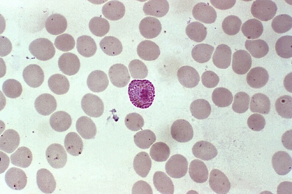 宏, microgametocytes, 产品, 红细胞, 循环