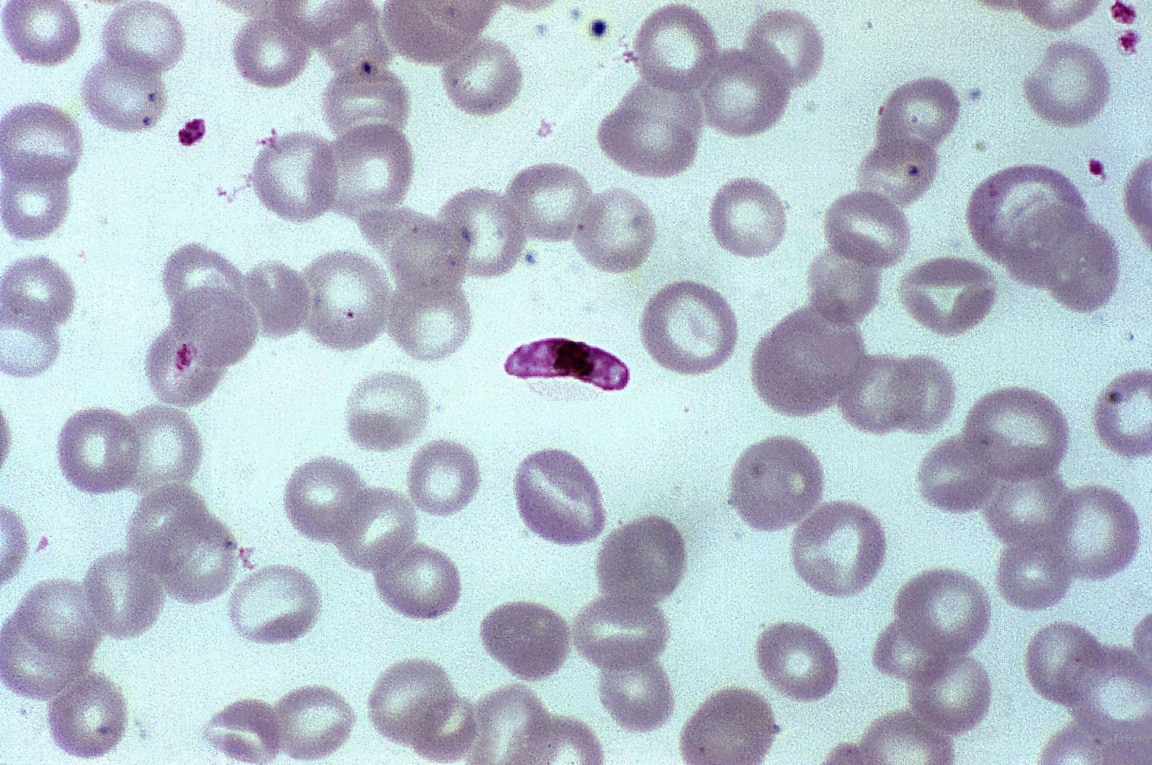 Плазмодий животное. Babesia canis под микроскопом.