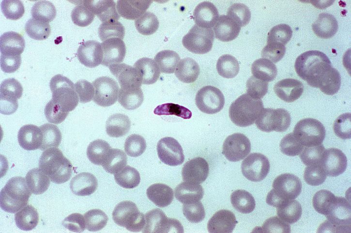 เพศชาย หญิง gametocytes กิน ยุงก้นปล่อง ยุง