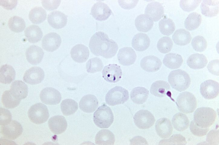 裂、赤、血液、細胞、感染症、熱帯熱マラリア原虫、寄生虫、特定、テクニック