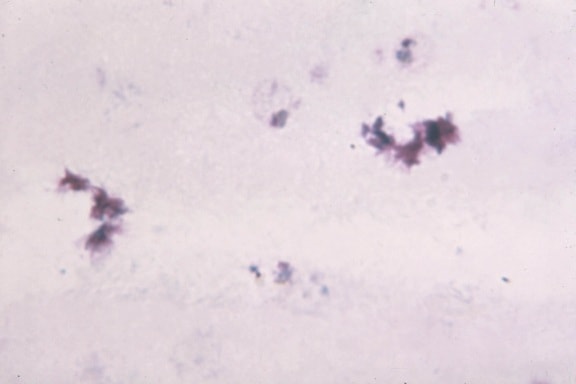 dark, regular, cytoplasm, conspicuous, pigment, evidence, schuffners, dots