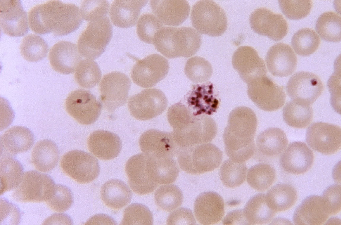 Kostenlose Bild wächst Plasmodium malariae trophozoite Fleck mag x