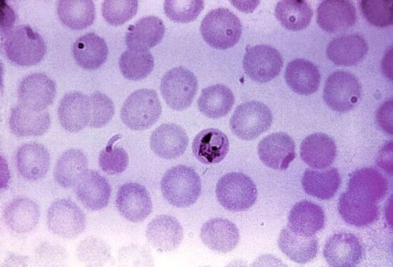 Kostenlose Bild Blutausstrich Mikrophotographie Plasmodium Falciparum Gametocyte