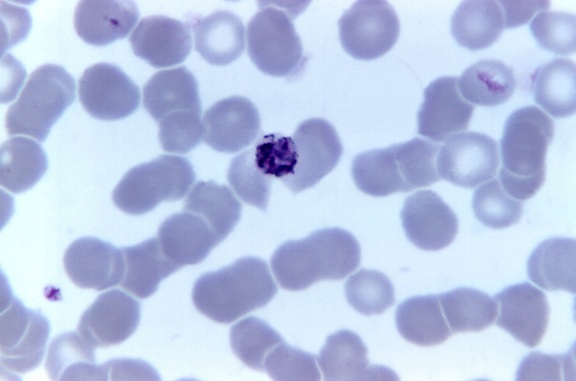 红细胞, schizogony, 寄生虫, 接受, 无性繁殖, 红细胞, 红细胞, schizogony