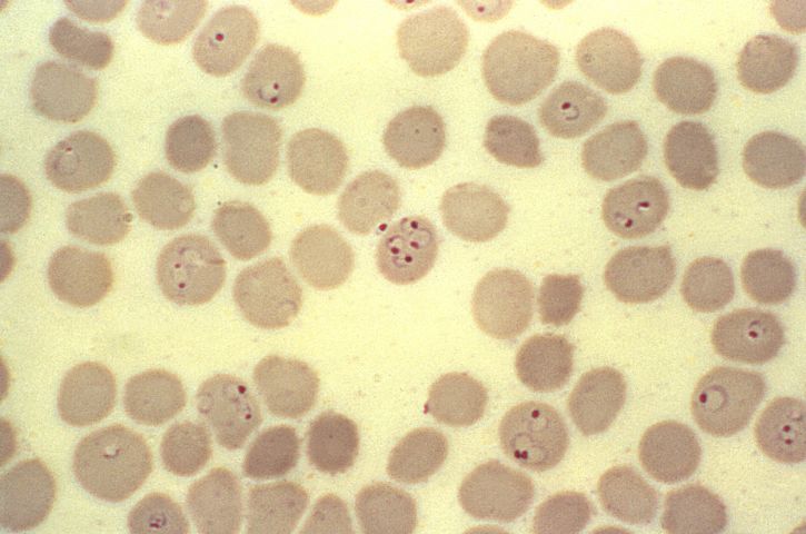 현미경 사진, 반지, 형태, 변형 체 falciparum, trophozoites