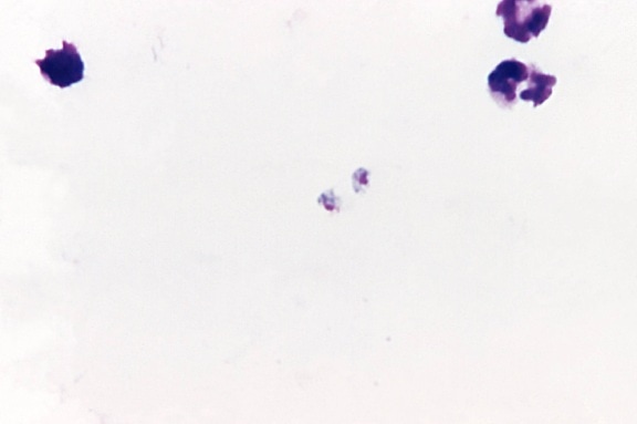 in crescita, Plasmodium malariae, trofozoite, macchia, MAG, 1125x