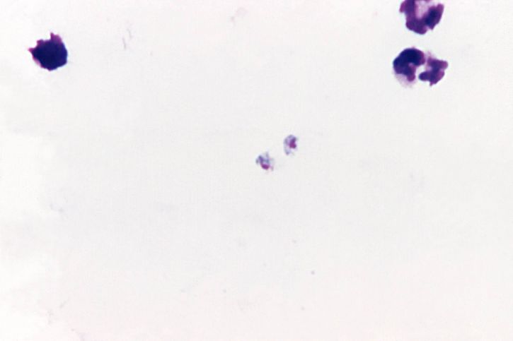 økende, plasmodium malariae, trophozoite, flekker, mag, 1125 x
