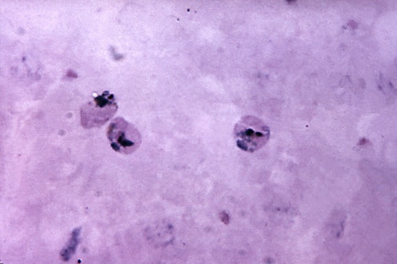 crescendo, jovem, ameboide, trofozoítos, parasita, vivax, ampliada, 1125 x